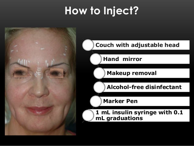 where can you inject botox